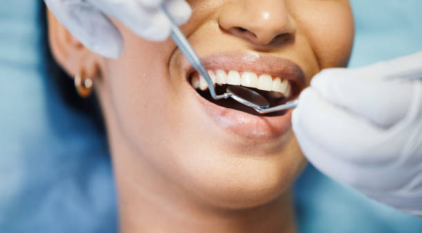 Best Holiday Emergency Dentist in Forsyth, IL