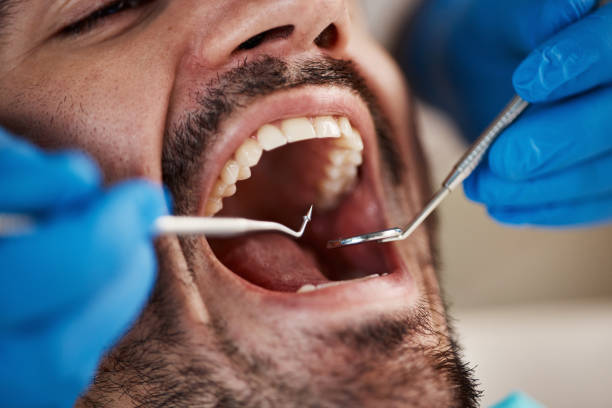 Best Pediatric Emergency Dentist in Forsyth, IL