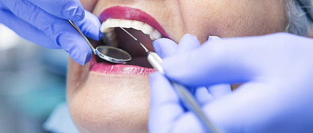 Best Mobile Emergency Dentist in Forsyth, IL
